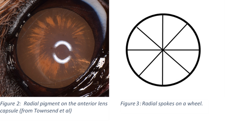 Photo of a dog lens demonstrating radial pigment.