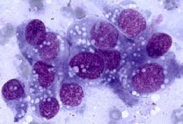 Hemangiosarcoma Under the Microscope