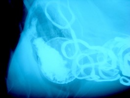 An X-Ray of a ball in a dog's stomach.